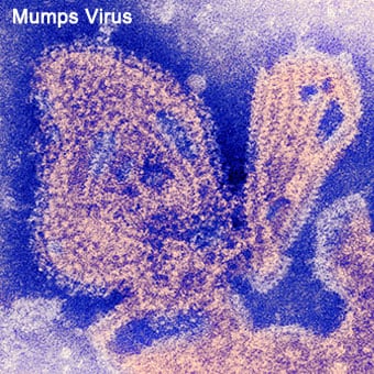 Virus gây bệnh quai bị