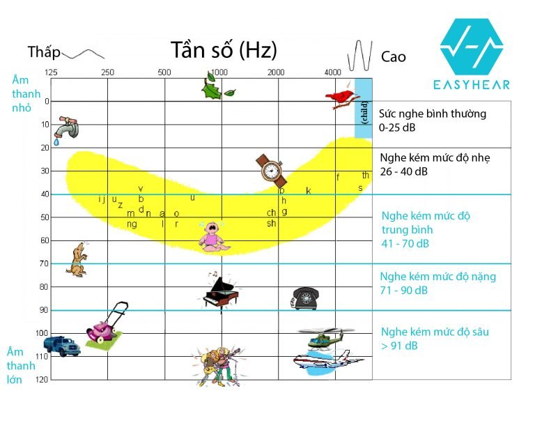 Các mức độ mất thính lực