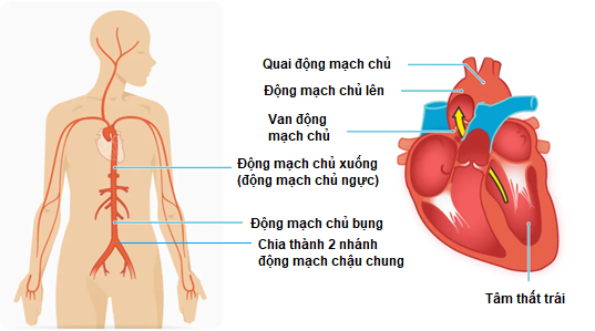 Động mạch chủ