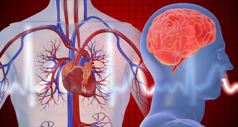 Đột quỵ & Đột tử do tim: Khác nhau như thế nào?