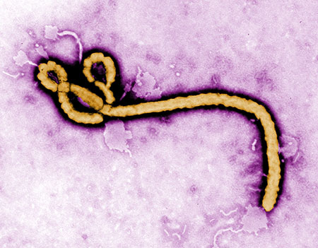 Ebola