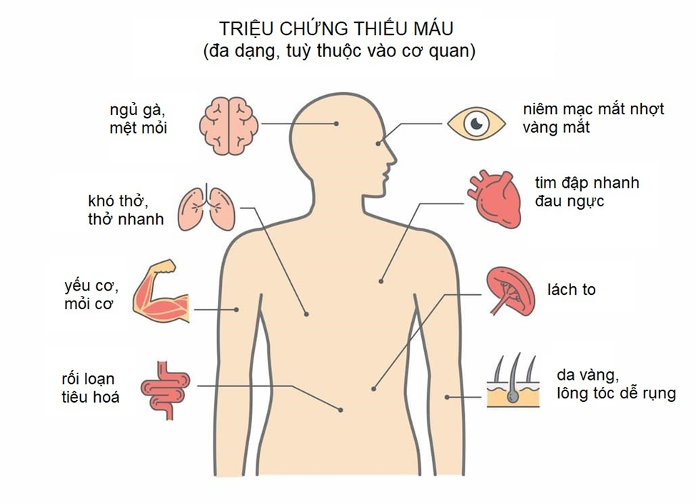 Thiếu máu trên bệnh nhân u lympho