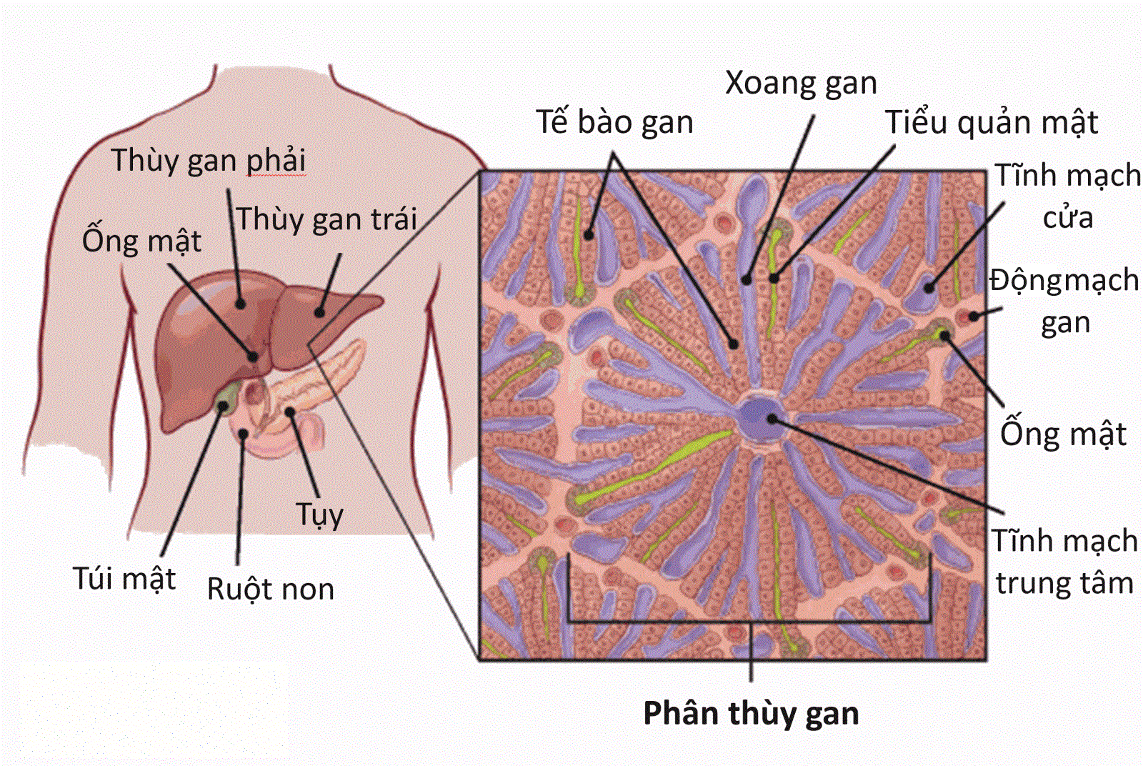 Ung thư gan