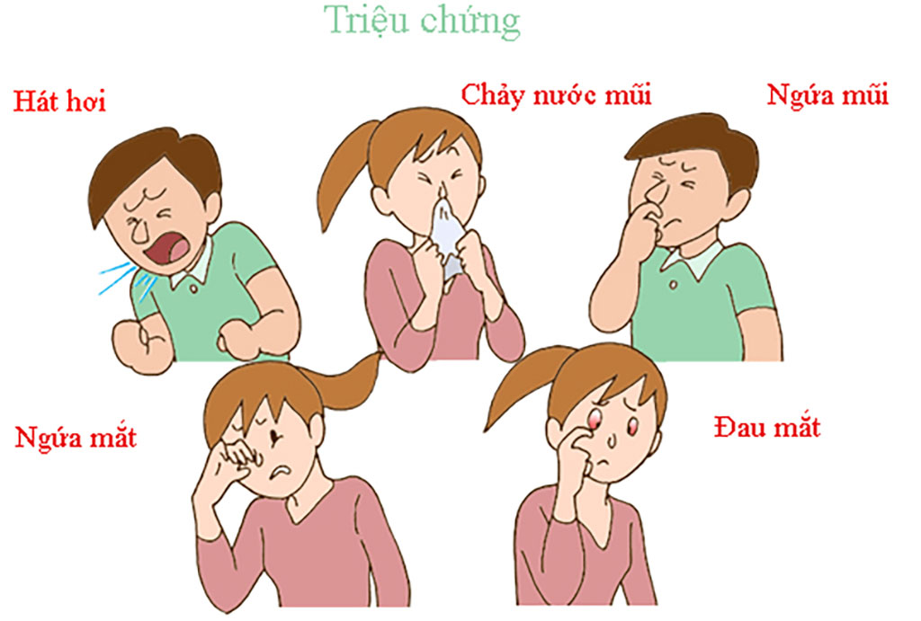 Các triệu chứng điển hình của Viêm mũi dị ứng