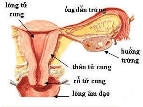 Viêm ống dẫn trứng