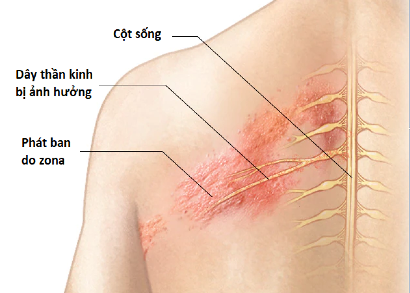 Zona thần kinh